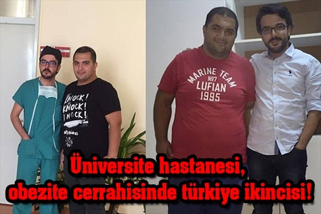 Üniversite hastanesi, obezite cerrahisinde türkiye ikincisi!
