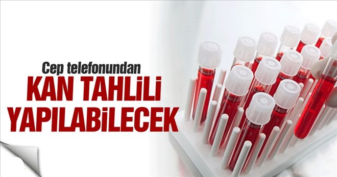 Cep telefonundan kan tahlili yapılabilinecek