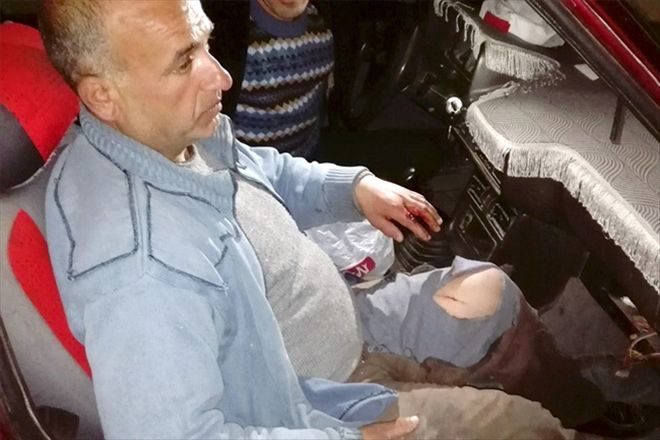 Domuzun  saldırdığı çoban  yaralandı