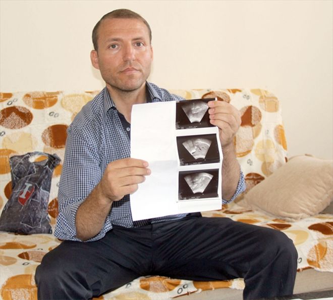 Babasından nakil aldığı böbreği de kaybetti