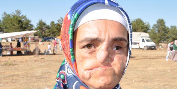 Yüzümü Değiştirin Evleneceğim