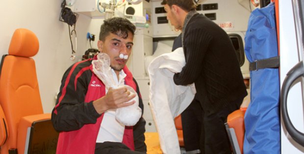 Sporcuya Saldırıp Burnunu Kırdılar