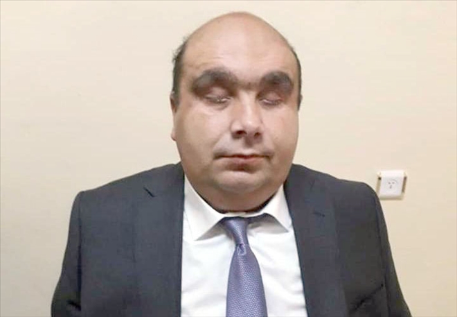 Sorunların Üzerine Kararlılıkla Gideceğiz