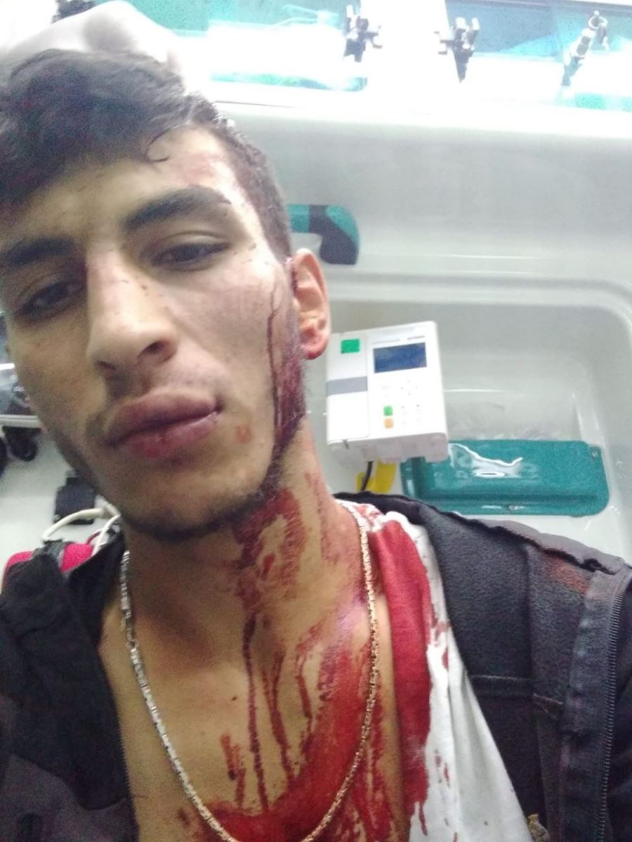 Harçlık Sevdası Hastanelik Etti!  