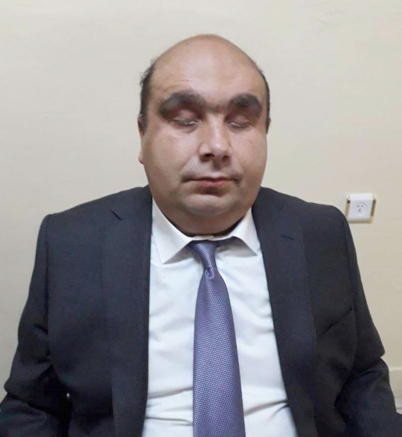 Herkes İçin Engelsiz Dünya