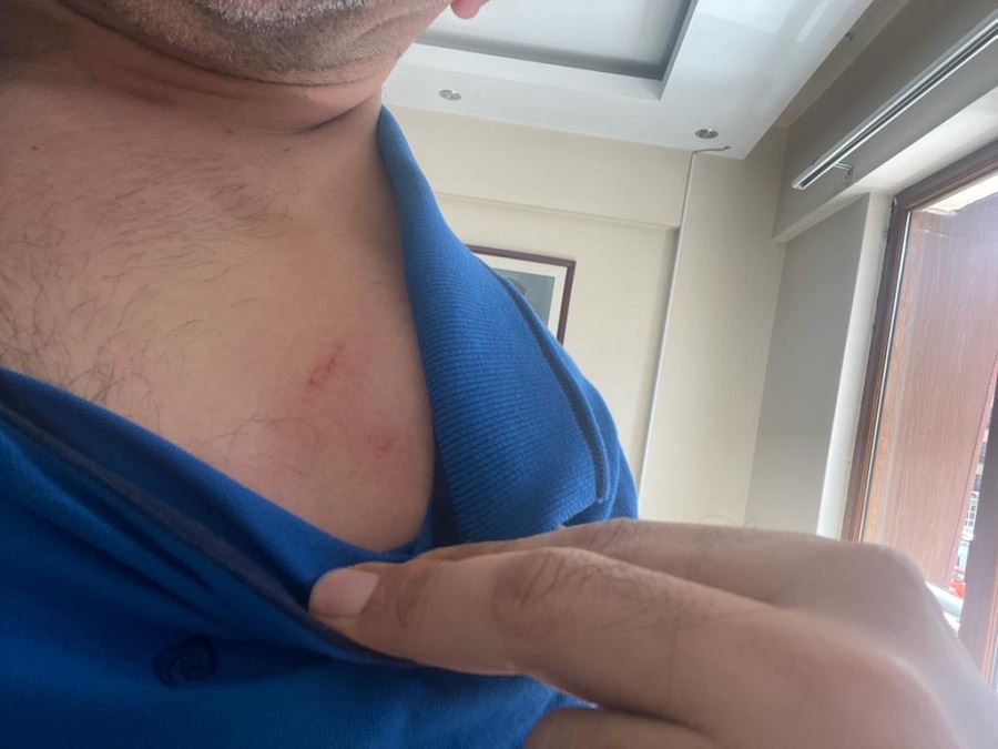 Polis Kılıklı Tiplerden Usandık!