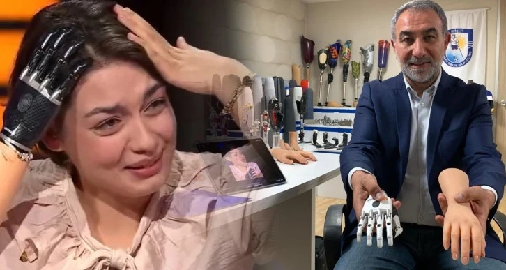 Herkesin Yüreğine Dokunan Rabia'ya Güzel Haber İş İnsanından Geldi, Protezini Yapacak 