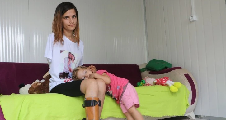 Depremde Kolunu Kaybeden Anne Biyonik Kol İstiyor 