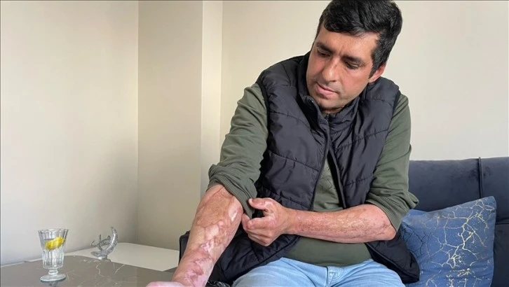 Maden Ocağındaki Patlamanın İzleri Silinmiyor! 