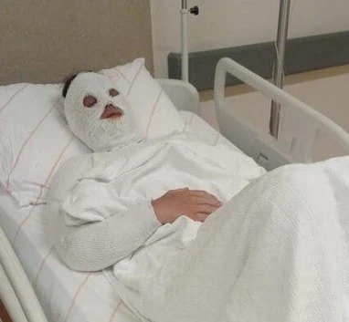 Eski Nişanlı Dehşeti:  Kadının Yüzüne Kimyasal Sıvı Attı 15 Yıl Hapis Verildi!