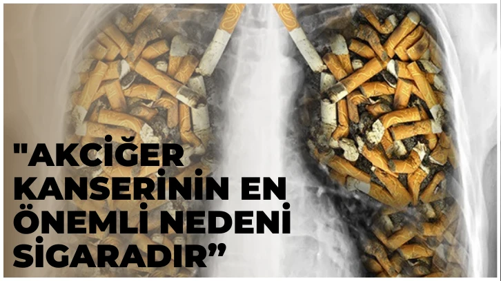 'Akciğer Kanserinin En Önemli Nedeni Sigaradır”