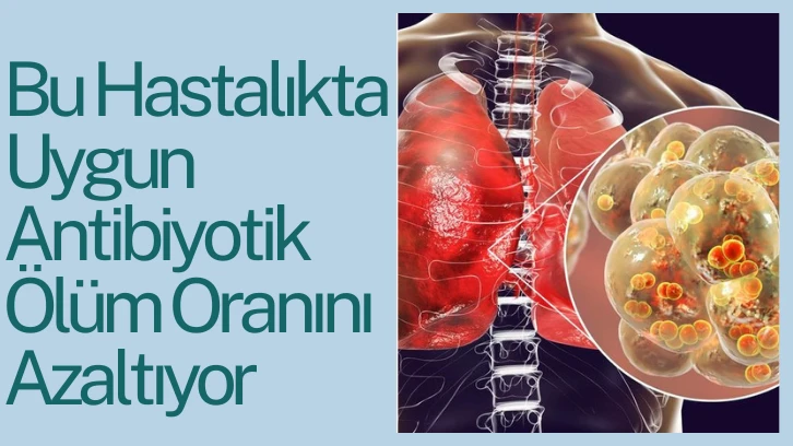 Bu Hastalıkta Uygun Antibiyotik Ölüm Oranını Azaltıyor