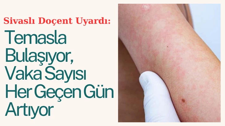 Sivaslı Doçent Uyardı: Temasla Bulaşıyor, Vaka Sayısı Her Geçen Gün Artıyor