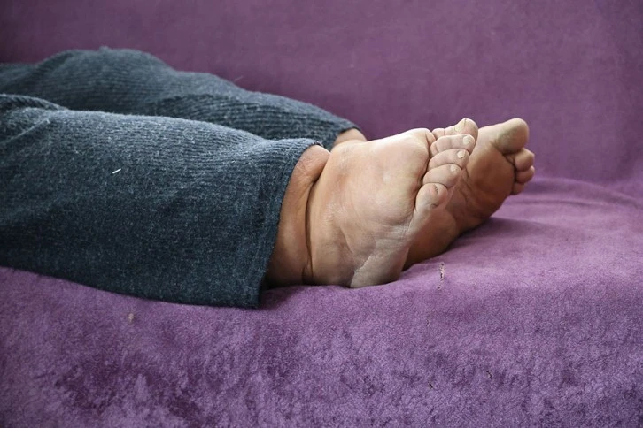 25 Yıldır Fil Hastalığı İle Mücadele Ediyor