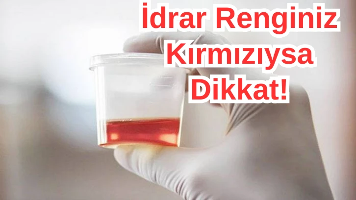 İdrar Renginiz Kırmızıysa Dikkat! 