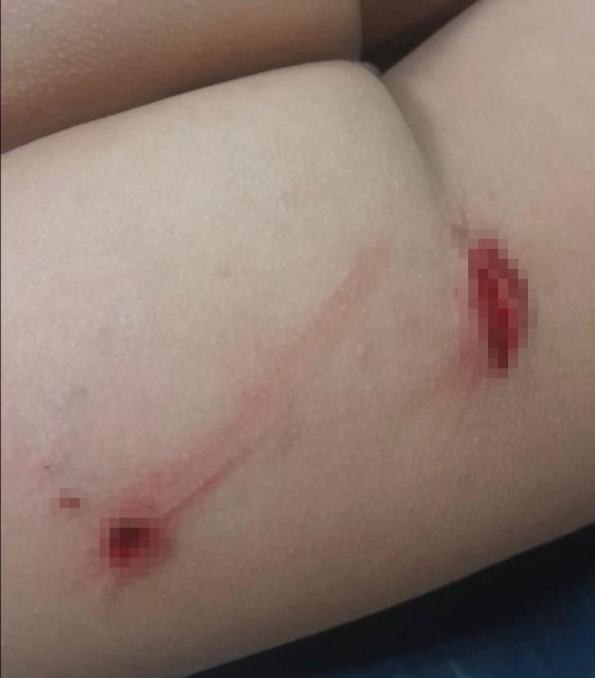 Başkentte Yine Başıboş Köpek Saldırısı 