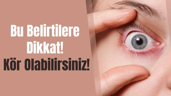 Bu Belirtilere Dikkat! Kör Olabilirsiniz! 