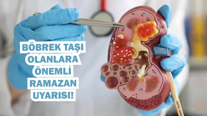 Böbrek Taşı Olanlara  Önemli  Ramazan  Uyarısı! 
