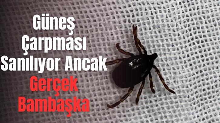 Güneş Çarpması Sanılıyor Ancak Gerçek Bambaşka 