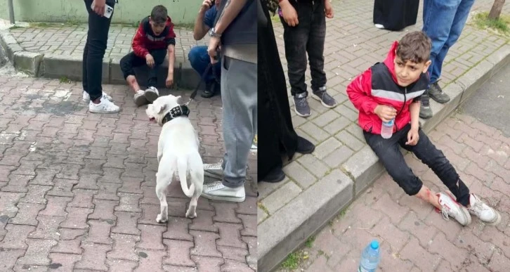 Başıboş bir köpek 12 yaşındaki çocuğu ısırdı