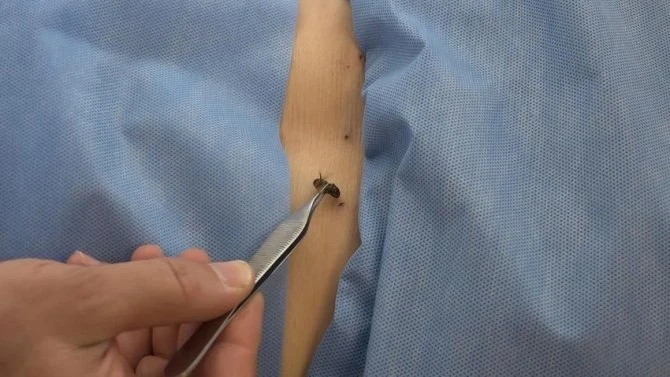 5 Bin Yıllık Tedavi Her Hastalığa İyi Geliyor 