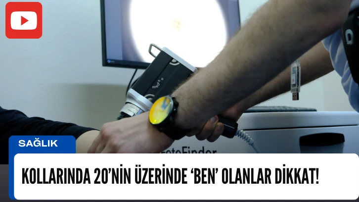  Kollarında 20’nin üzerinde ‘ben’ olanlar dikkat!