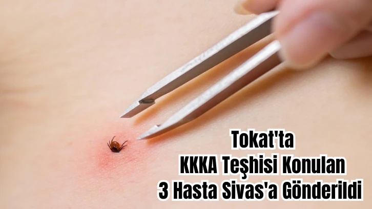 Tokat'ta KKKA Teşhisi Konulan 3 Hasta Sivas'a Gönderildi 