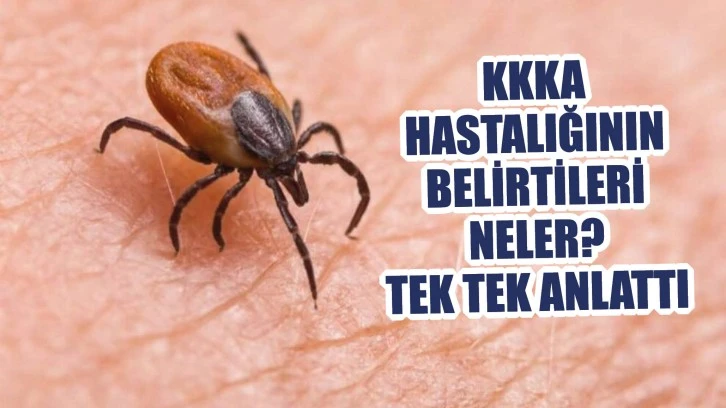 KKKA Hastalığının Belirtileri  Neler? Tek Tek Anlattı
