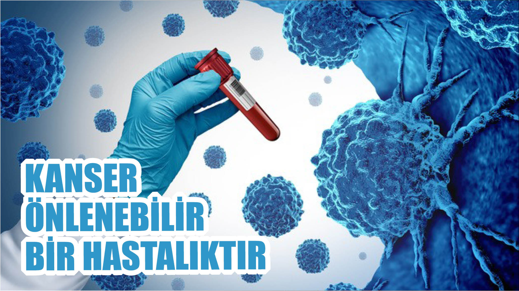 Kanser Önlenebilir Bir Hastalıktır