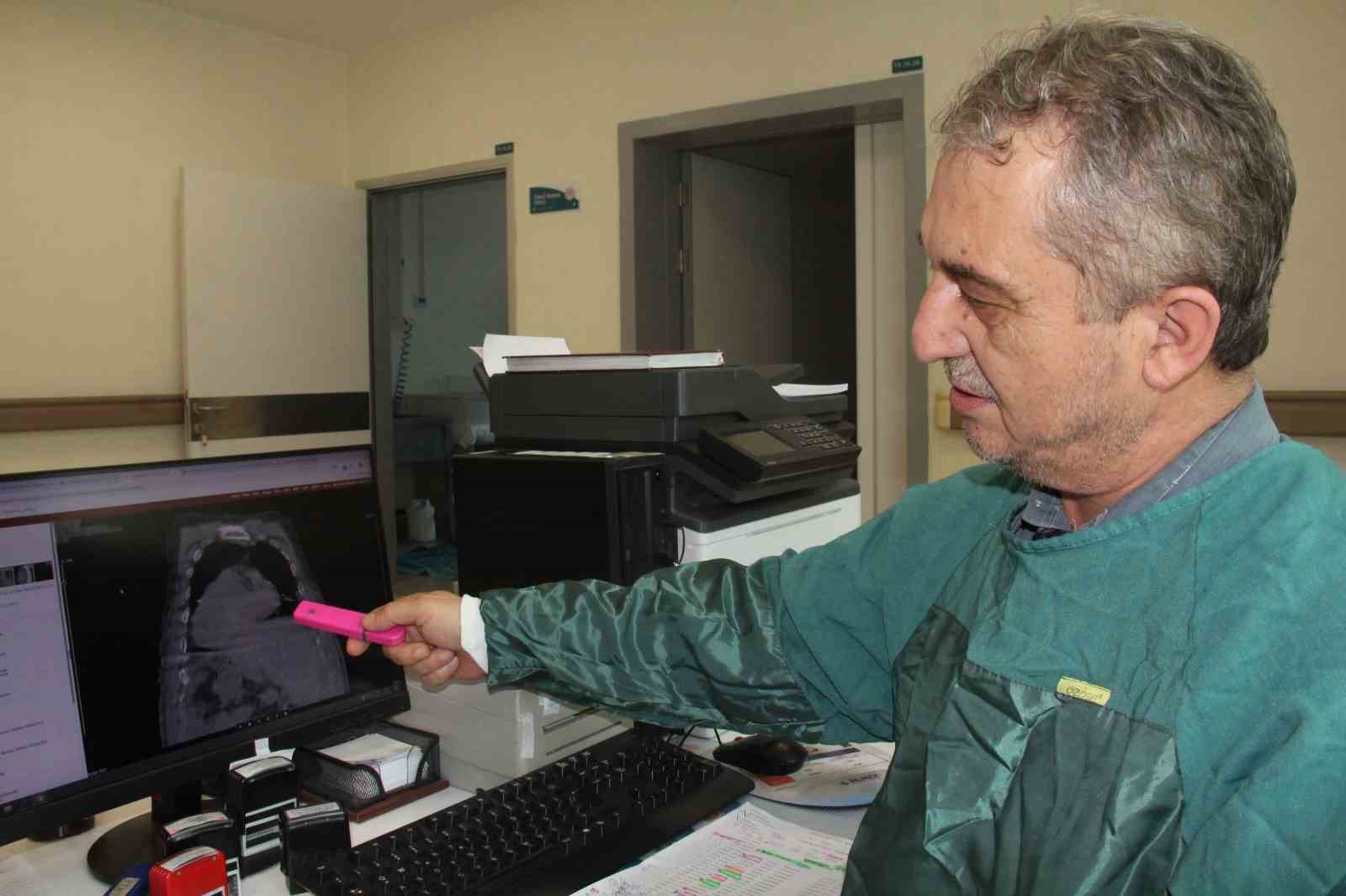Tıp literatüründe yeni bir tanı: 'Karadeniz Sendromu'
