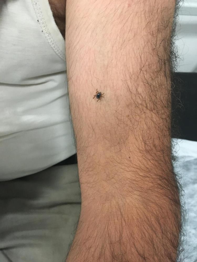 Kene vakalarında doğru bilinen çok fazla yanlış var!