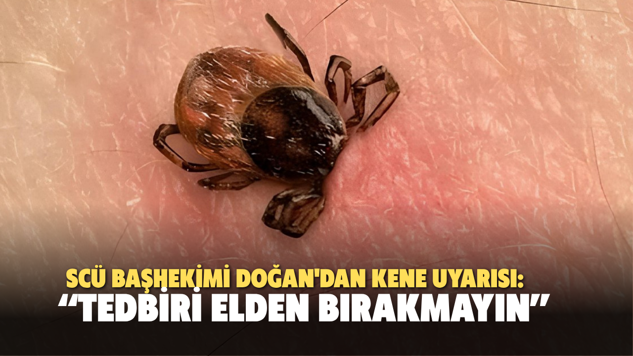SCÜ Başhekimi Doğan'dan kene uyarısı: “Tedbiri Elden Bırakmayın”