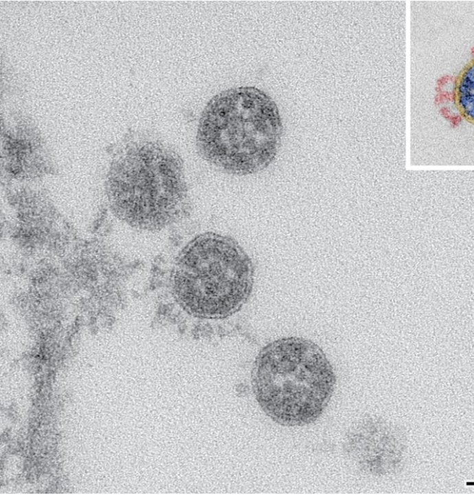Yeni ‘Frankenstein’ COVID-19 Varyantı Nedir? XFG Hakkında Bilmeniz Gerekenler