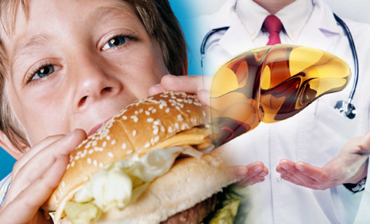 Sivas'tan ailelere uyarı! Çocuklarda karaciğer yağlanmasına dikkat