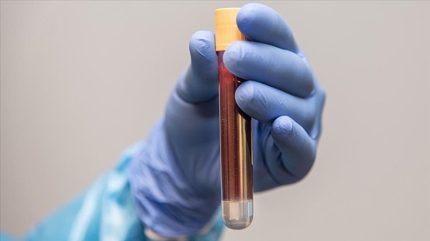 Kardeşi prostat kanseri olanlar dikkat!