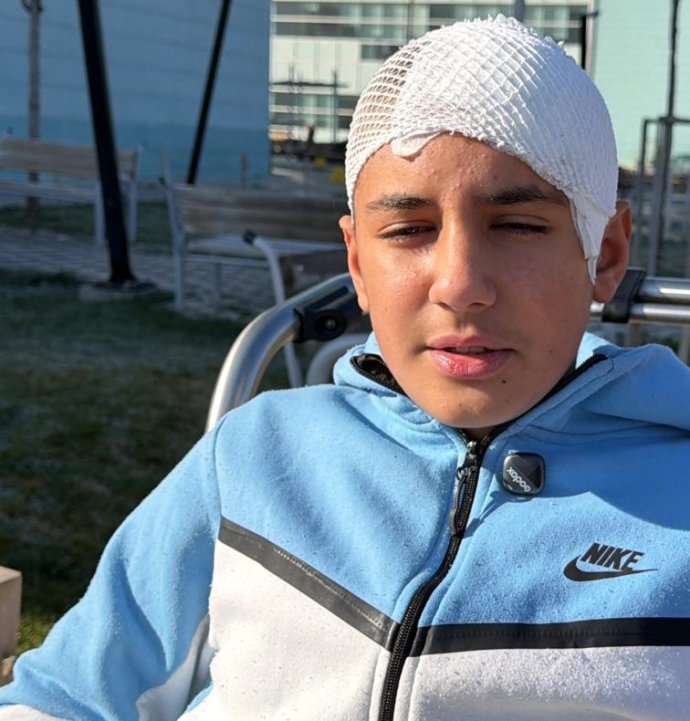 Akran zorbalığına maruz kalan çocuğun kafatası titanyumla tedavi edildi