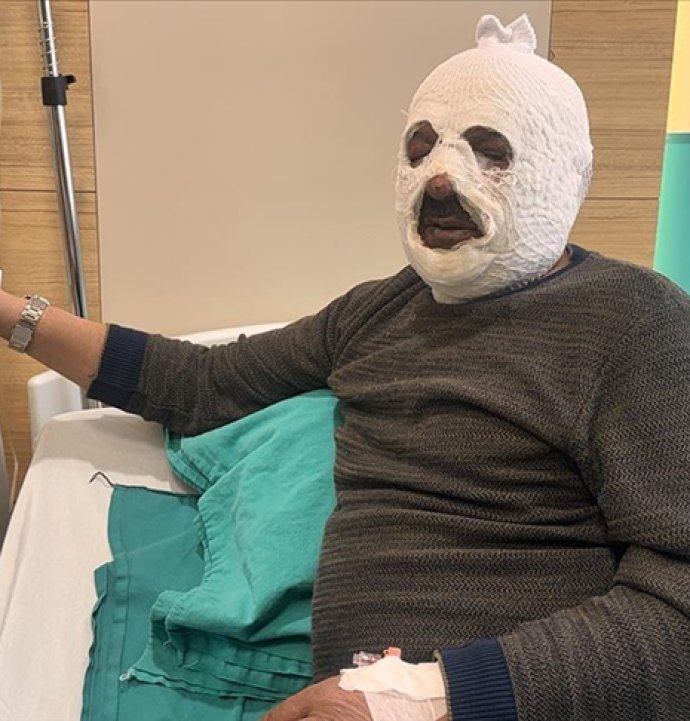 Kalorifer kazanını yakmak için döktüğü benzin az daha canından ediyordu