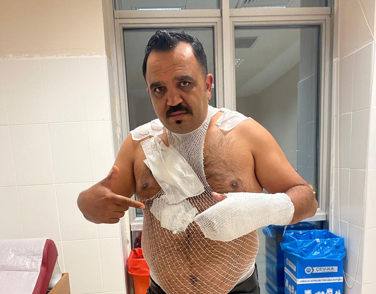 Meşhur tostçu, soğuk havada şov yapmak isterken kendini yaktı