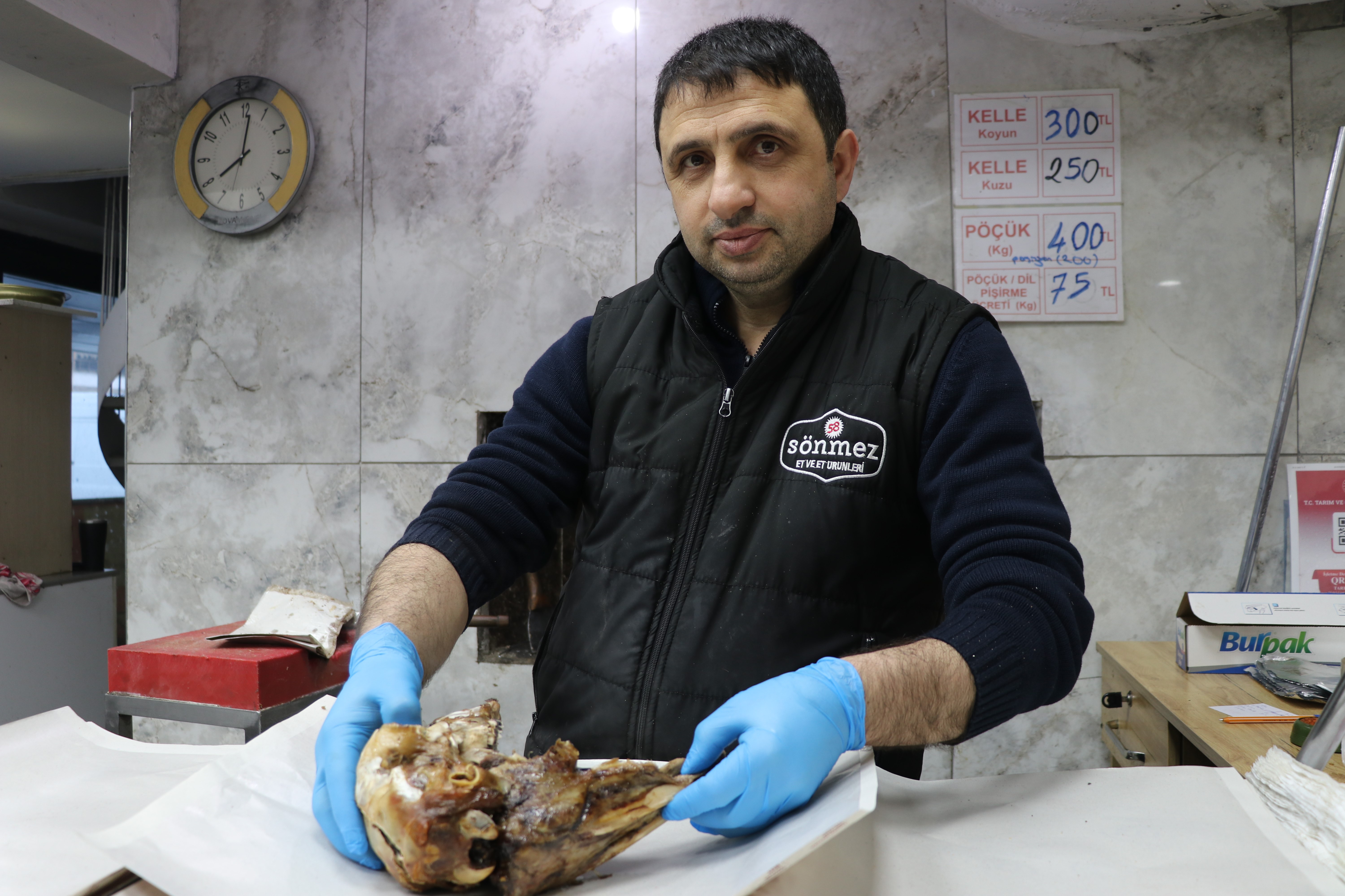 'Gözünün yağını yiyeyim' deyimi buradan geliyor