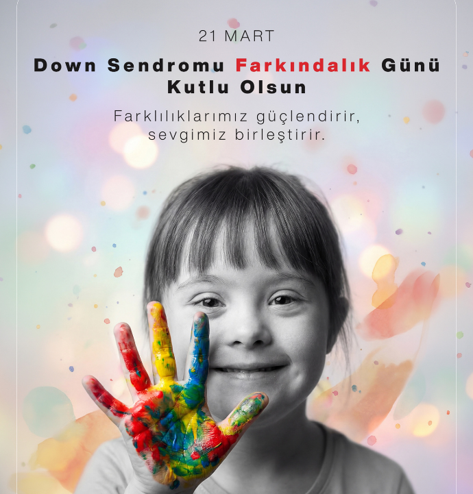 Sivas Belediyesi’nden Down Sendromu Farkındalık Günü mesajı