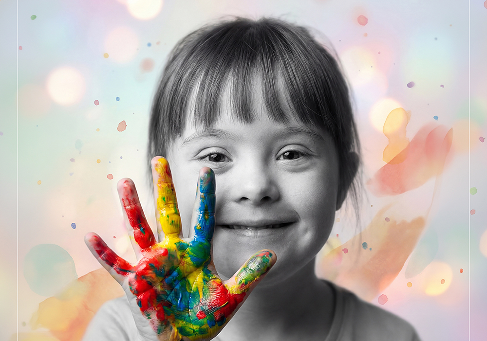 Sivas Belediyesi’nden Down Sendromu Farkındalık Günü mesajı