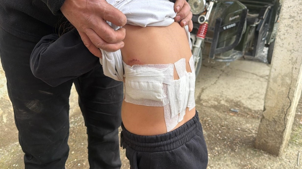 Eşek, 5 yaşındaki çocuğa saldırdı