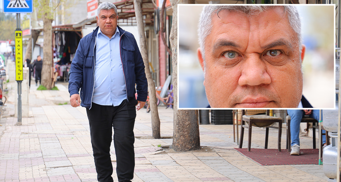 3 renkli gözleriyle görenlerin ilgisini çekiyor