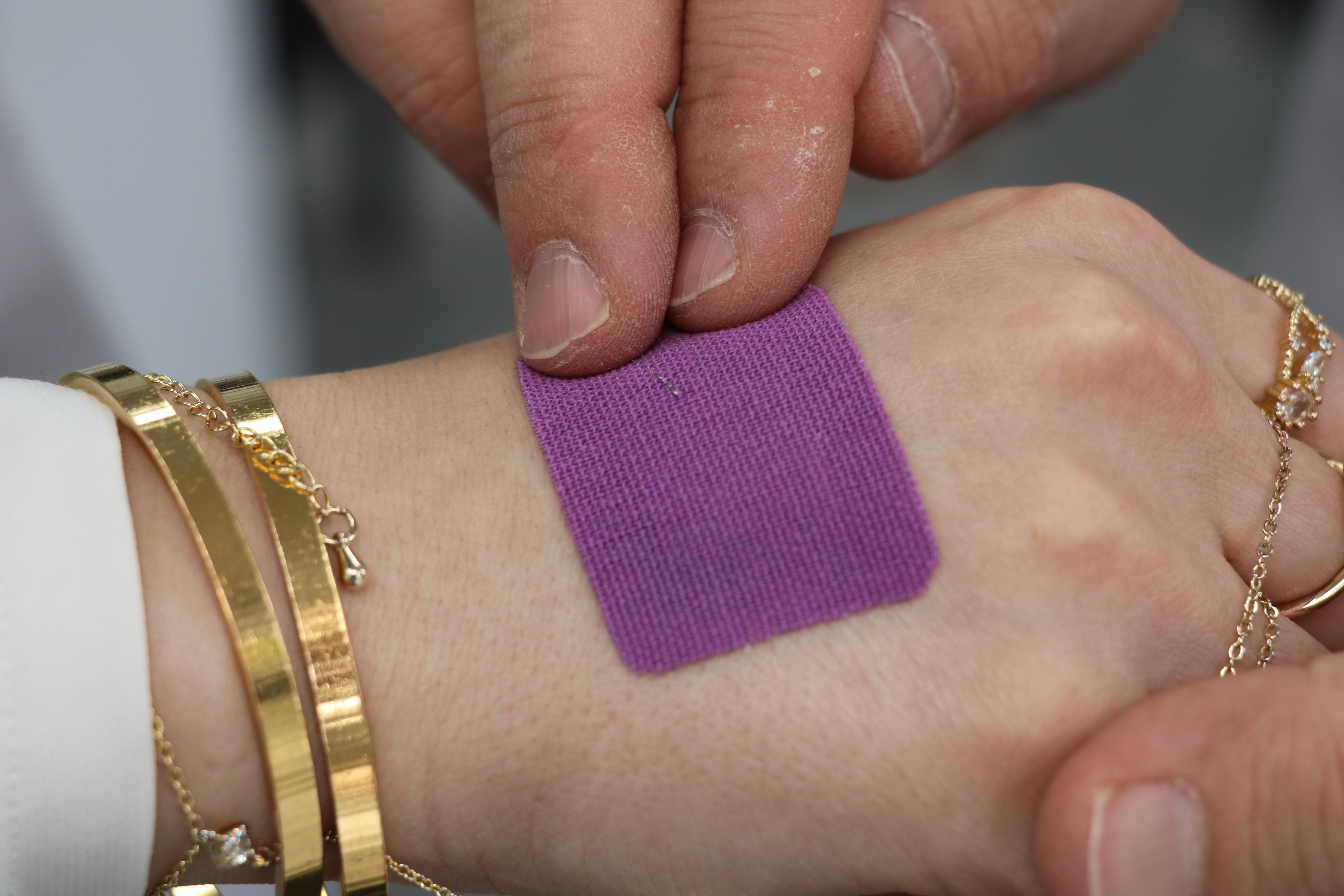 Nanoteknolojiyle geliştirildi! Yaraları daha hızlı iyileştiriyor