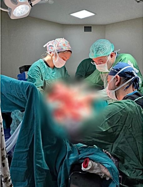 Sivas'ta bir hastanın göğsünden 7 kilo 750 gramlık tümör çıkarıldı