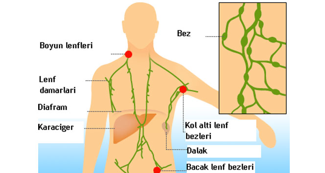 Uzun süren ve büyüyen lenf bezleri mutlaka değerlendirilmeli