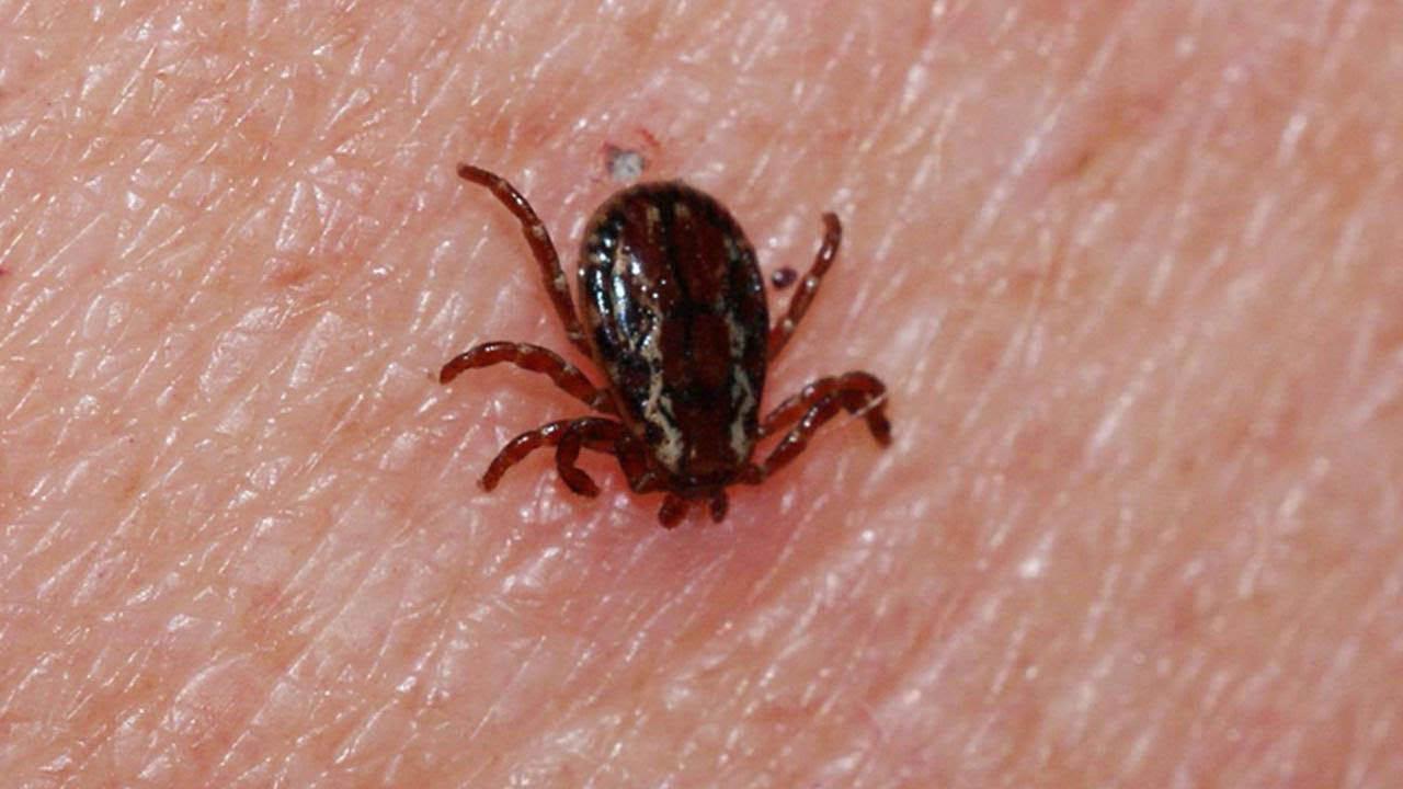 Sivas'ta kene tedavisi gören 35 yaşındaki hasta hayatını kaybetti