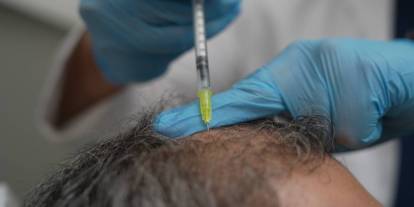 Dökülen saçlar vücudun bir alarmı olabilir