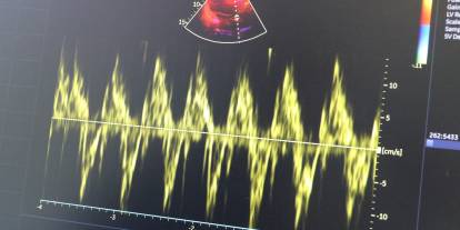 Uzmanı uyardı: "Kalp hastaları soğuk havada daha dikkatli olmalı"