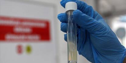 Tüberküloz nedeniyle her yıl bir milyon kişi hayatını kaybediyor